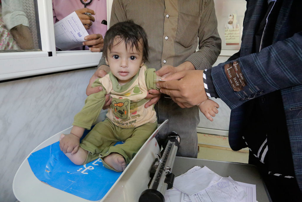 yemen malnutrition
